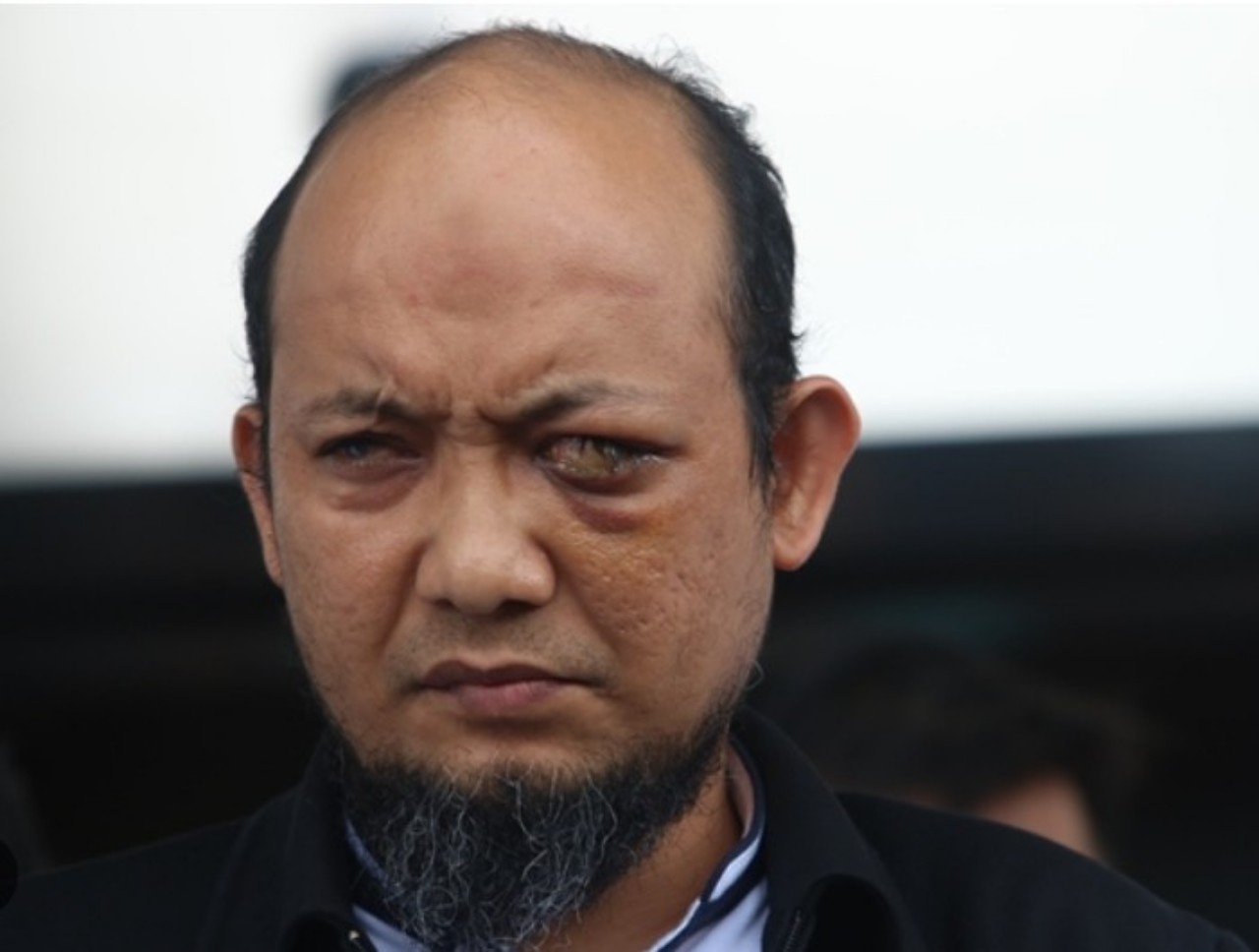 Kasus Penyiraman Air Keras Andrie Yunus Jadi Sorotan, Novel Baswedan Duga Pelaku Berniat Membunuh