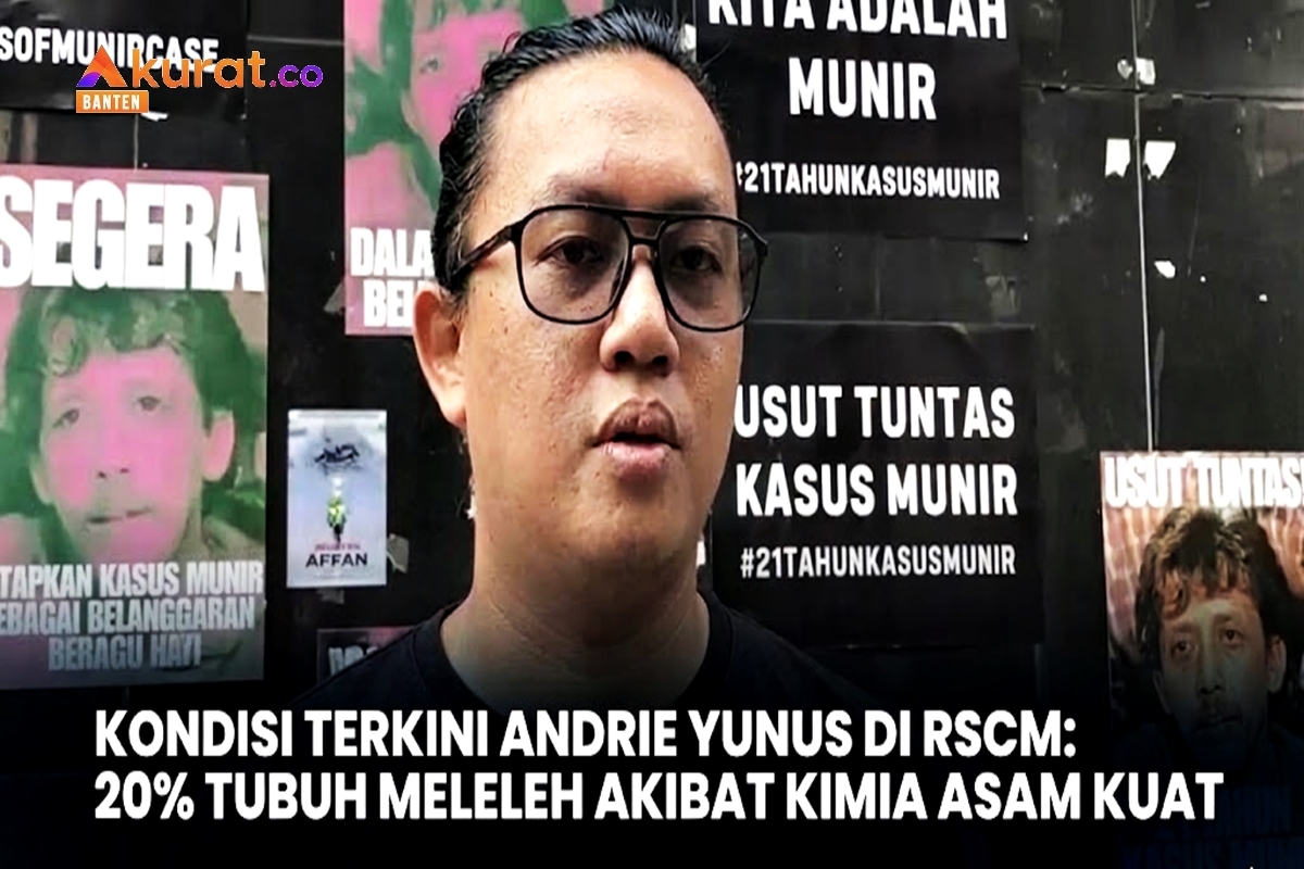 Kondisi Terkini Andrie Yunus di RSCM: 20 Persen Tubuh Meleleh Akibat Kimia Asam Kuat, Akankah Kembali Normal?