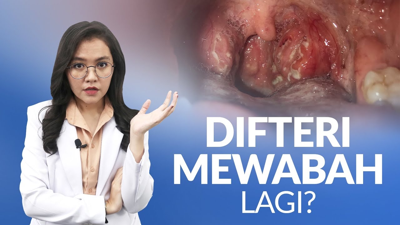 Awas! Wabah Difteri Meningkat 2026, Penyakit Paling Menular dan Picu Kematian Sejumlah Wilayah di Indonesia
