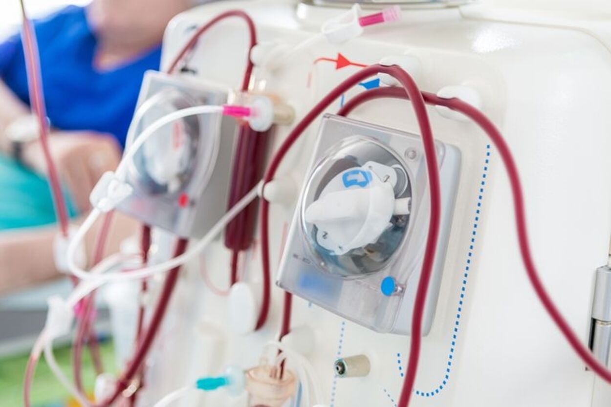 Kisah Pilu Pasien Cuci Darah Kelimpungan Akibat BPJS PBI Nonaktif, KPCDI Angkat Suara