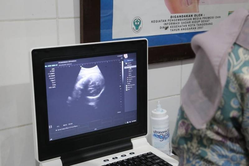 Kabar Baik! USG di 39 Puskesmas Kota Tangerang Kini Gratis