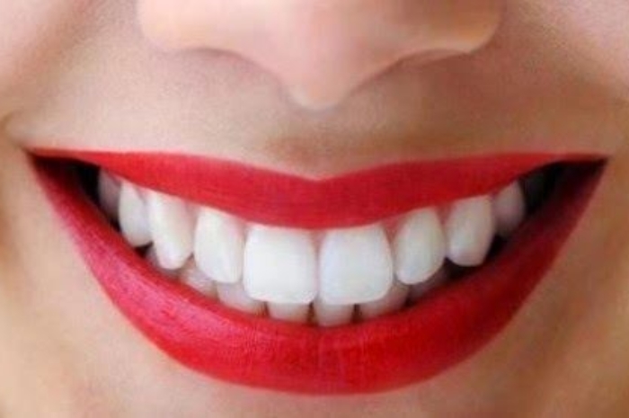 Wajib Tahu! Ini Tips Memutihkan Gigi Secara Alami agar Lebih Pede Tersenyum