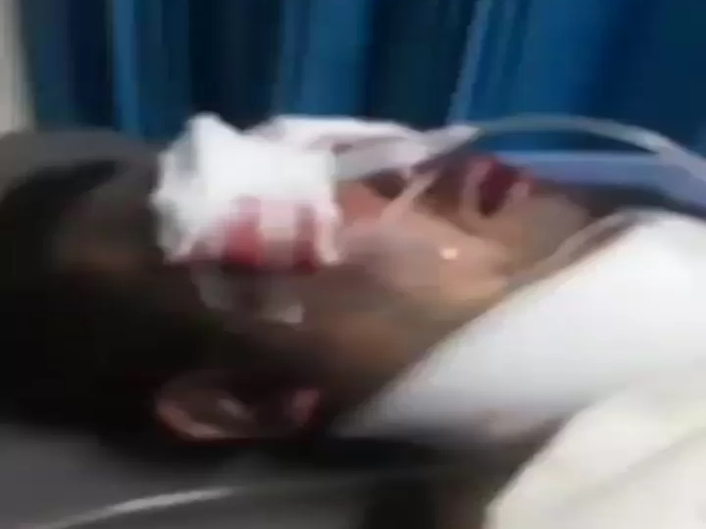 Seorang Pria Mencongkel Mata Lawannya Saat Keduanya Bersitegang di Gunung Putri, Diduga Mencintai Wanita yang Sama, Akhirnya Menyerahkan Diri