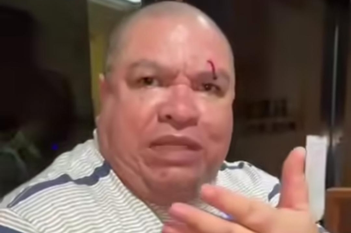 Perseteruan Memanas! Nikita Mirzani Diduga Pukuli Razman Nasution dan Istrinya, Kening Berdarah dan Tangan Memar