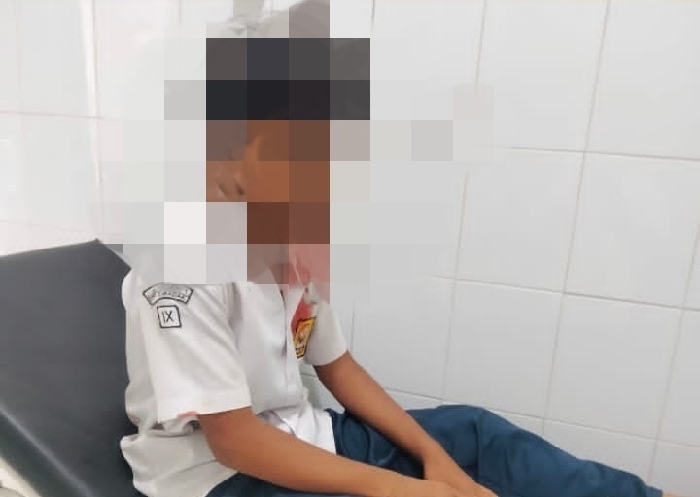 Siswa SMP di Lebak Dibacok Orang Tidak Dikenal, Polisi Buru Pelaku