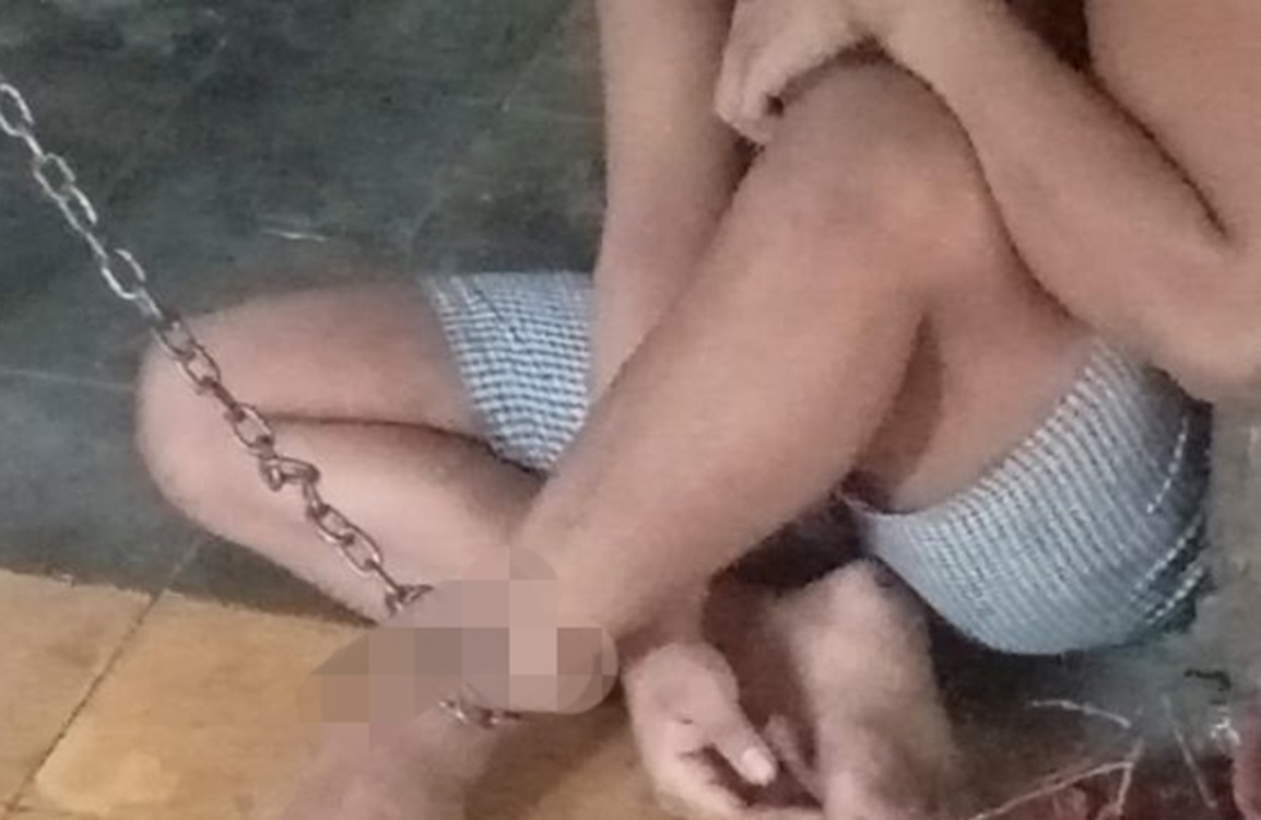 Subki Warga Lebak Terpaksa di Pasung, Karena Alami Gangguan Jiwa dan Sering Ngamuk