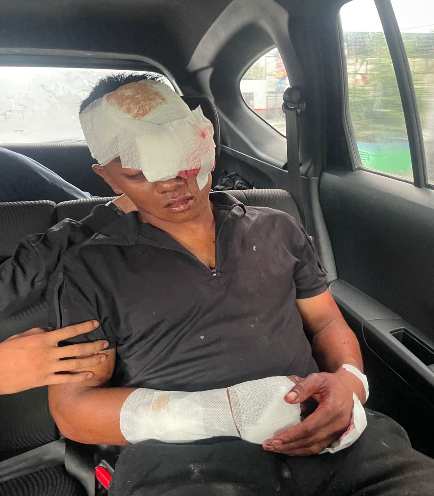 Sadis! Geng Motor Bacok Anggota Yonif 100/PS di Petisah Medan, Alami Luka Serius Hingga Dilarikan RS Bunda Thamrin