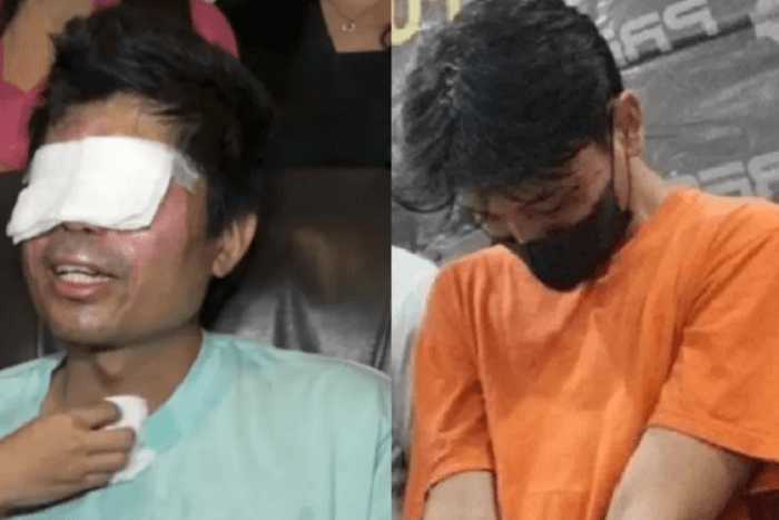 Penglihatan Buta Akibat Penyiraman Air Keras, Agus Berharap Pelaku Dihukum Mati