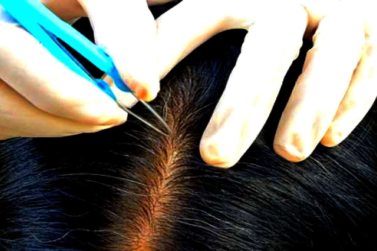 Tips! Hindari Mencabut Uban, Kerena Dipercaya Malah Bertambah Banyak, Mitos atau Fakta?